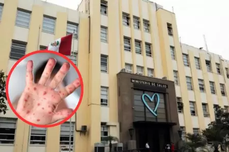 Minsa emite alerta epidemiol�gica ante posible importaci�n y contagio de sarampi