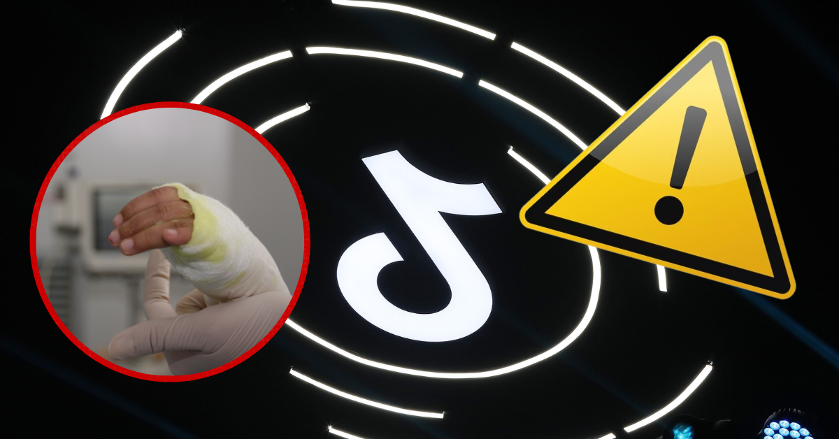 ¡Atención, padres! Niños resultan heridos tras realizar reto viral de TikTok con microondas