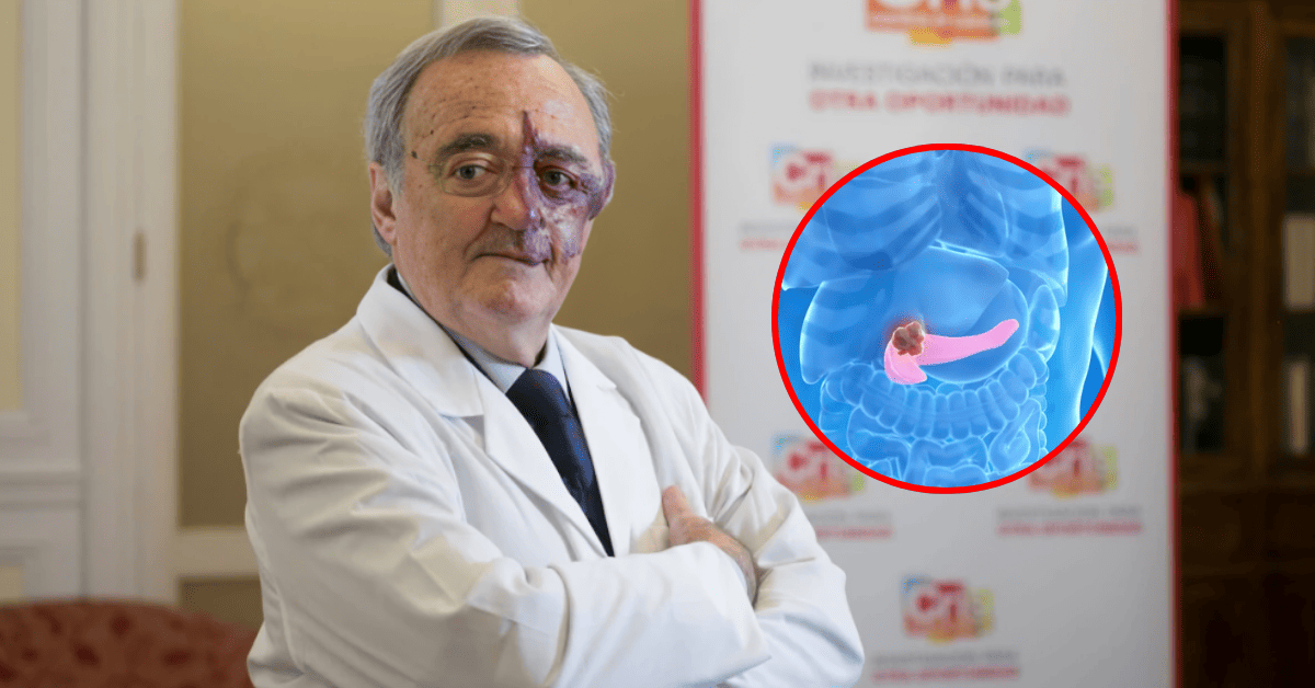Oncólogo que eliminó el cáncer de páncreas en animales recaudó 3.5 millones de euros para curarlo en humanos