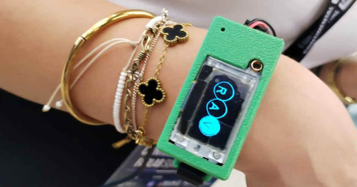 Uso de dispositivos médicos portátiles o wearables no reemplazan al médico, sostiene experto