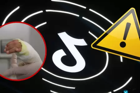 Ni�os resultan heridos tras realizar trend de TikTok