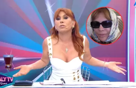 Magaly responde a las cr�ticas que recibe por su cirug�a facial