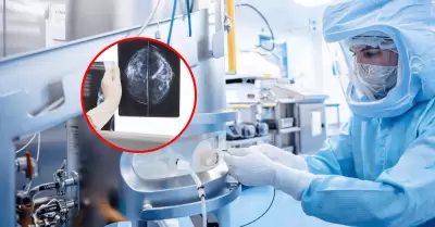 Vacuna contra el c�ncer de mama triple negativo mostr� eficacia en ensayo cl�nic