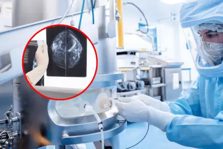 Vacuna contra el c�ncer de mama triple negativo mostr� eficacia en ensayo cl�nic