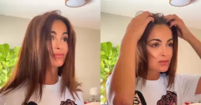 Laura Spoya reaparece en redes sociales tras accidente