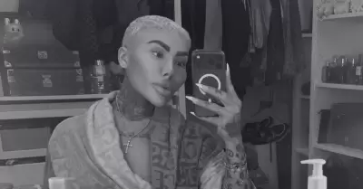 Muere influencer que quer�a parecerse a Kim Kardashian