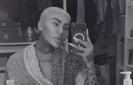 Muere influencer que quer�a parecerse a Kim Kardashian