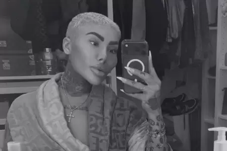 Muere influencer que quer�a parecerse a Kim Kardashian