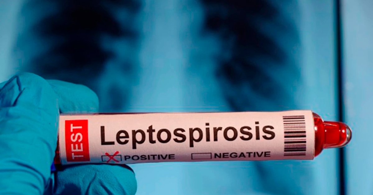 Alertan casos de leptospirosis en el Per�.