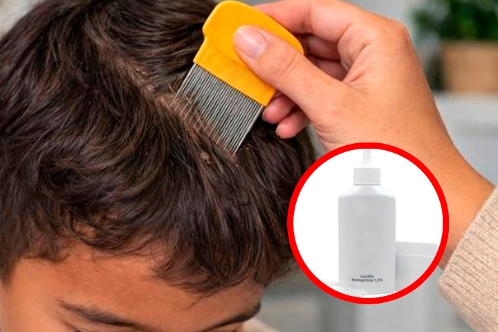 Se recomienda uso de loci�n y peine patrullero para el cuidado.