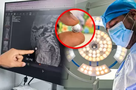 Menor fue sometida a una operaci�n compleja de m�s de 3 horas.