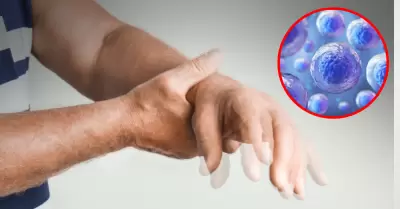 Jap�n aprueba el primer tratamiento mundial con c�lulas madre para el Parkinson