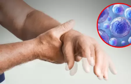 Jap�n aprueba el primer tratamiento mundial con c�lulas madre para el Parkinson