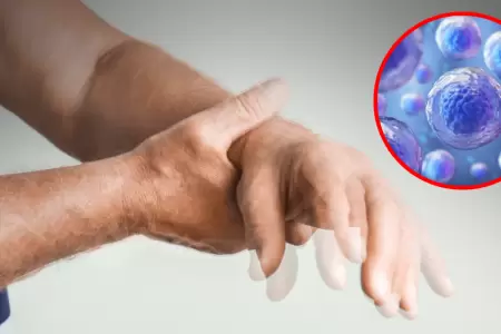 Jap�n aprueba el primer tratamiento mundial con c�lulas madre para el Parkinson