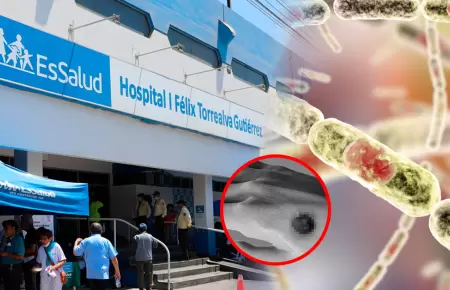 Pruebas de la identificaci�n de la bacteria resultaron negativas