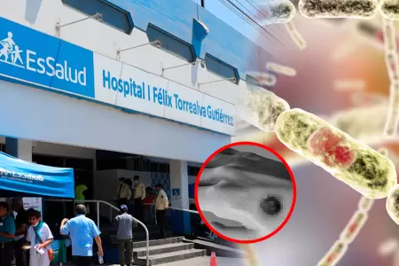 Pruebas de la identificaci�n de la bacteria resultaron negativas