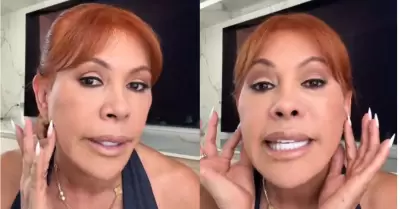 Magaly revela que perdi� sensibilidad en las orejas tras cirug�as facial