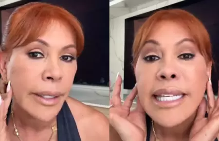 Magaly revela que perdi� sensibilidad en las orejas tras cirug�as facial