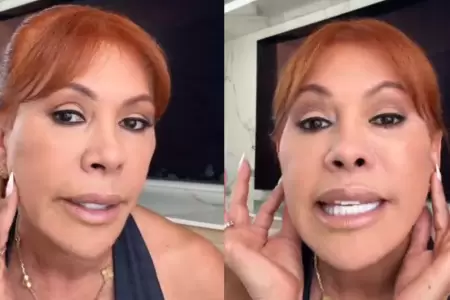 Magaly revela que perdi� sensibilidad en las orejas tras cirug�as facial