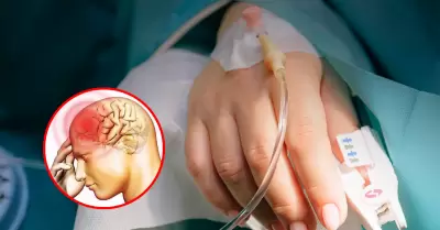 Brote de meningitis deja DOS MUERTOS