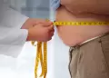 �C�mo se trata hoy la obesidad?: Conoce LOS MITOS que retrasan el diagn�stico y tratamiento adecuados