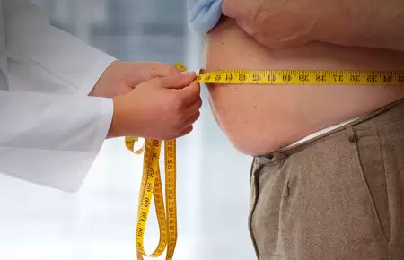 �C�mo se trata hoy la obesidad?