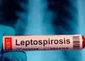 Confirman segunda muerte por leptospirosis en Tumbes: V�ctima contrajo enfermedad tras contacto con agua empozada
