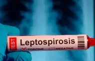 Confirman segunda muerte por leptospirosis en Tumbes: V�ctima contrajo enfermedad tras contacto con agua empozada