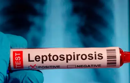 Alertan casos de leptospirosis en el Per�.