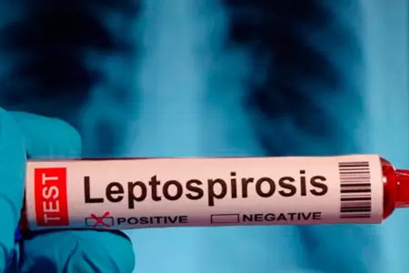 Alertan casos de leptospirosis en el Per�.