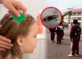 Minsa alerta sobre contagio de piojos en escolares y brinda consejos para evitar propagaci�n