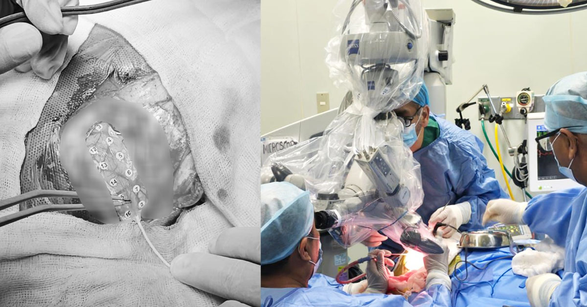 Beb� de un a�o fue sometido a cirug�a de alta complejidad.