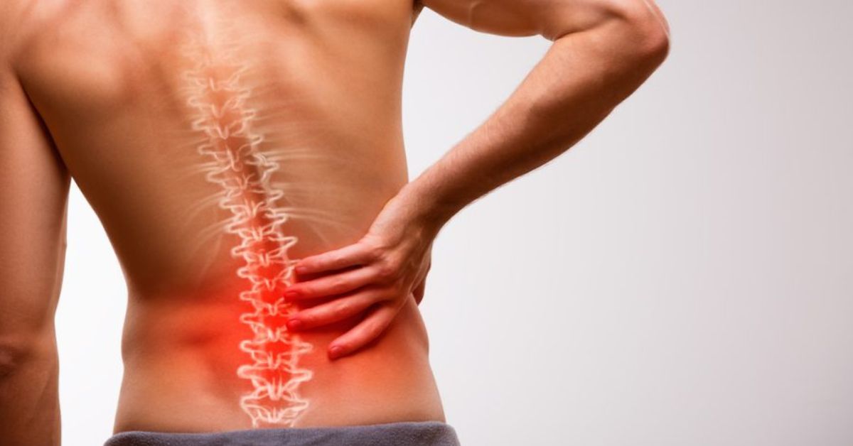 Minsa lanza alerta: claves para prevenir la ciática y evitar dolores crónicos en la columna