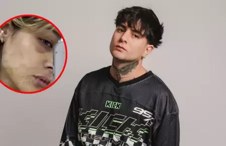 Streamer "Diealis" es denunciado NUEVAMENTE por agresi�n a su expareja