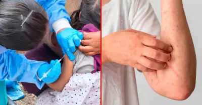 Diresa de Puno anunci� que se mantendr� una vigilancia epidemiol�gica de 21 d�as