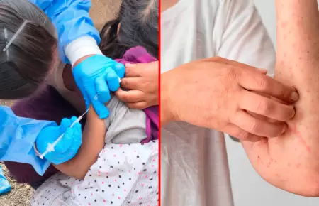 Diresa de Puno anunci� que se mantendr� una vigilancia epidemiol�gica de 21 d�as