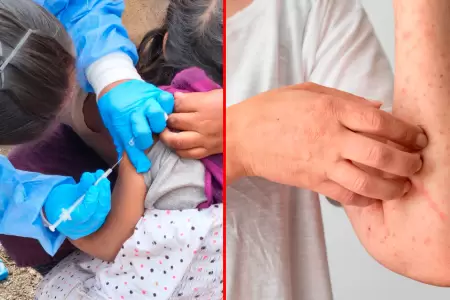 Diresa de Puno anunci� que se mantendr� una vigilancia epidemiol�gica de 21 d�as