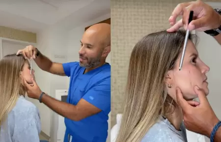 Alejandra Baigorria se somete a 'retoquito' por condici�n m�dica