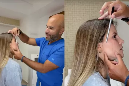 Alejandra Baigorria se somete a 'retoquito' por condici�n m�dica