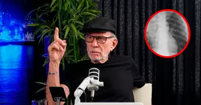 El candidato por Partido Obras anunci� padecer una anomal�a.