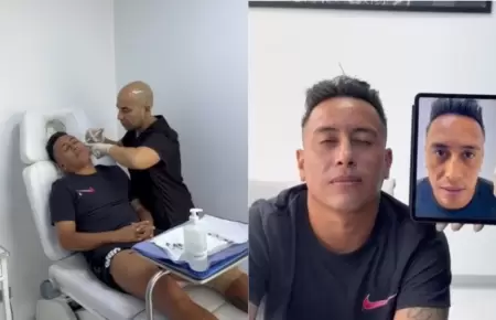 Christian Cueva se hace retoquito