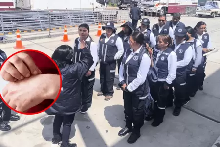 Minsa despliega brigadas de salud en Juliaca por brote de sarampi�n