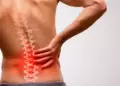 Minsa lanza alerta: claves para prevenir la ci�tica y evitar dolores cr�nicos en la columna