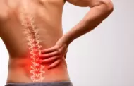 Minsa lanza alerta: claves para prevenir la ci�tica y evitar dolores cr�nicos en la columna