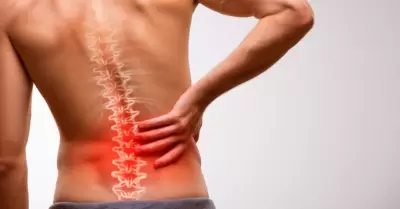 Minsa lanza alerta claves para prevenir la ci�tica y evitar dolores cr�nicos en