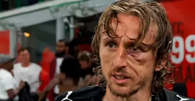 Luka Modric sufri� una dura lesi�n contra la Juventus el �ltimo fin de semana.