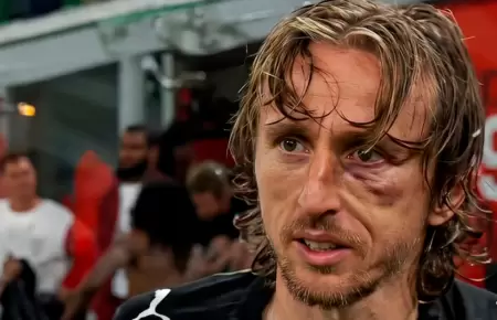 Luka Modric sufri� una dura lesi�n contra la Juventus el �ltimo fin de semana.