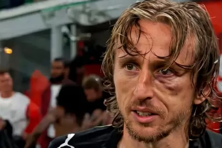 Luka Modric sufri� una dura lesi�n contra la Juventus el �ltimo fin de semana.