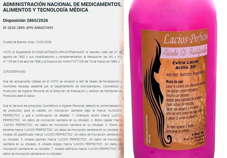 ANMAT exige que se retire productos de 'Lacios Perfectos'