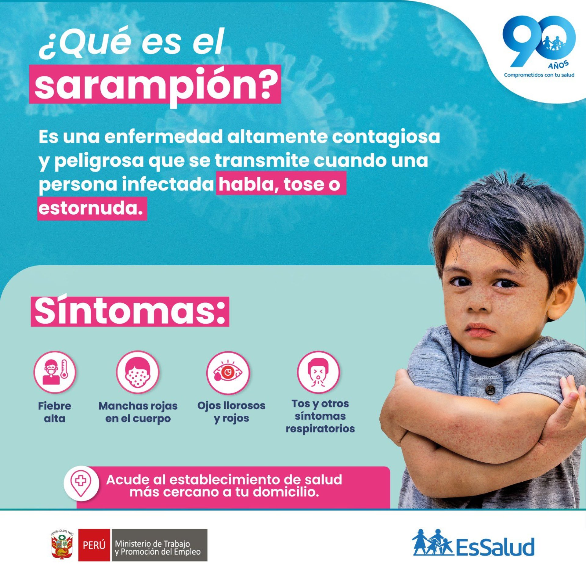 ¿Qué es el sarampión?